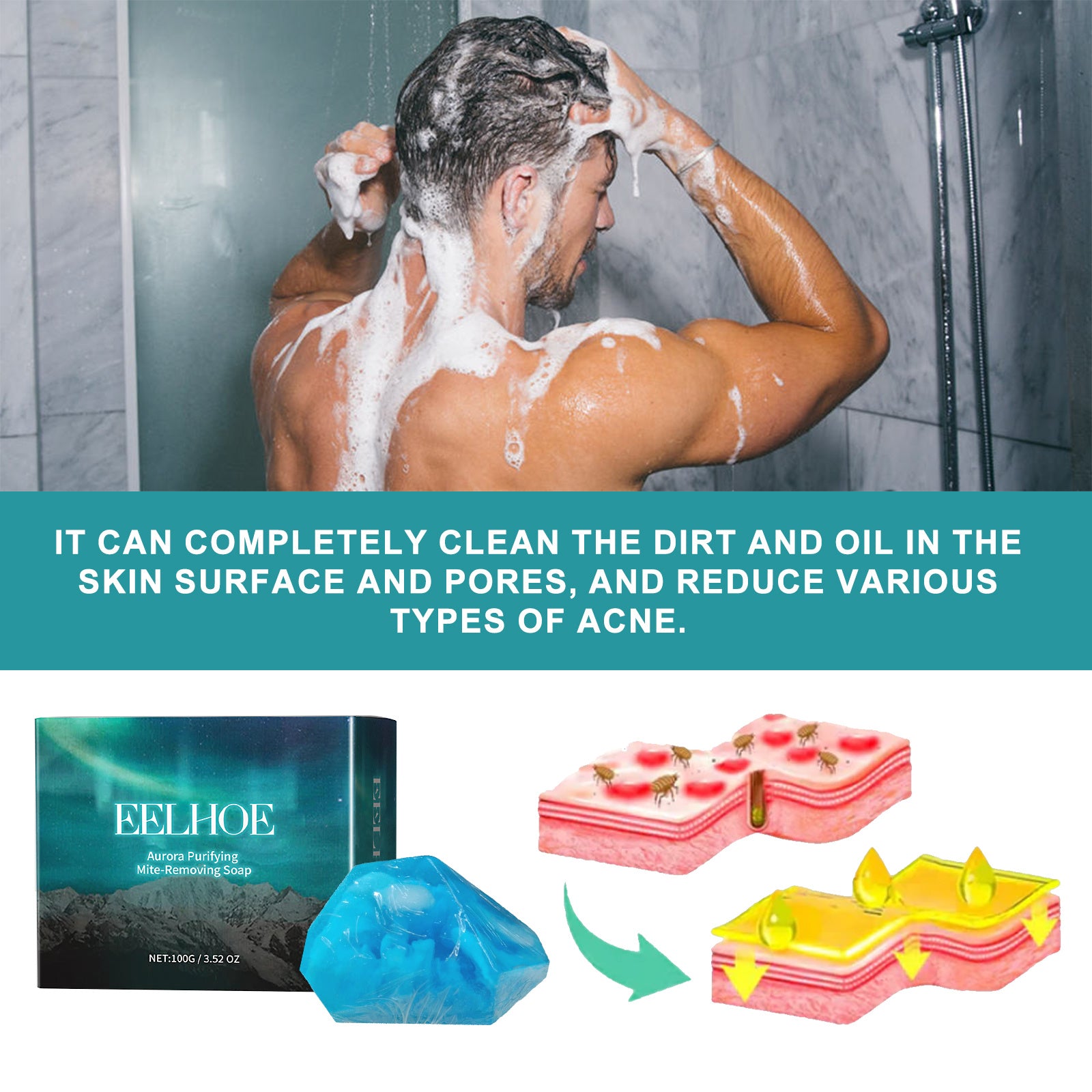 EELHOE Aurora Purifying Mite-Removing Soap, Deep Cleansing Facial Body Skin Fade Acne Print Multi-Effect Cleansing Soap